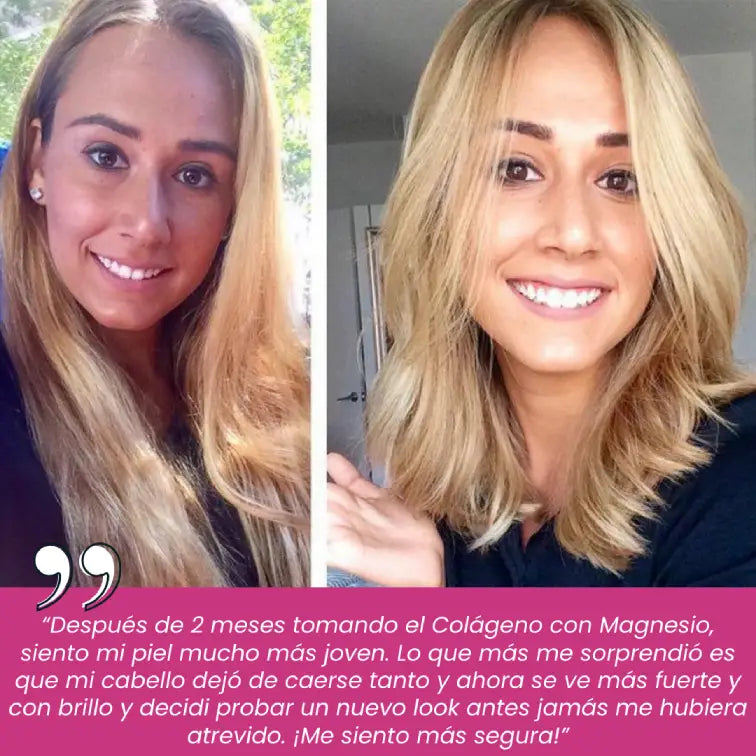 Colágeno con cloruro de Magnesio | Articulaciones libres de dolor y piel rejuvenecida en menos de 45 días